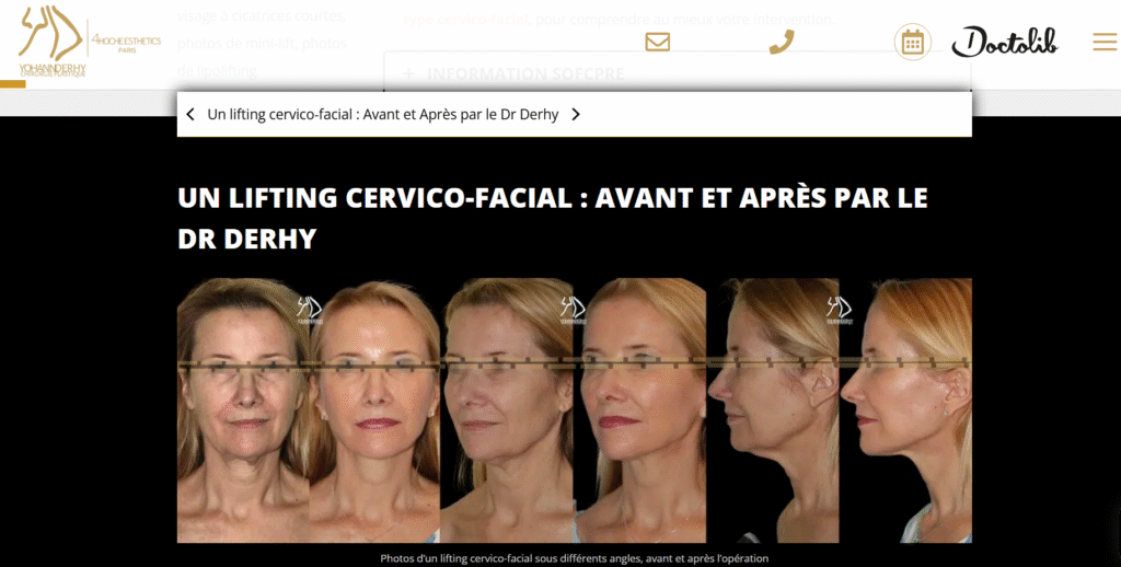exemple d'une page avant/après dont le but est de donner confiance au lecteur